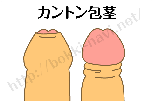 �u�NNavi�b�j����g���u���E�u�N�E��s�E���a�̏����