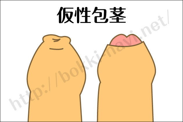 �u�NNavi�b�j����g���u���E�u�N�E��s�E���a�̏����