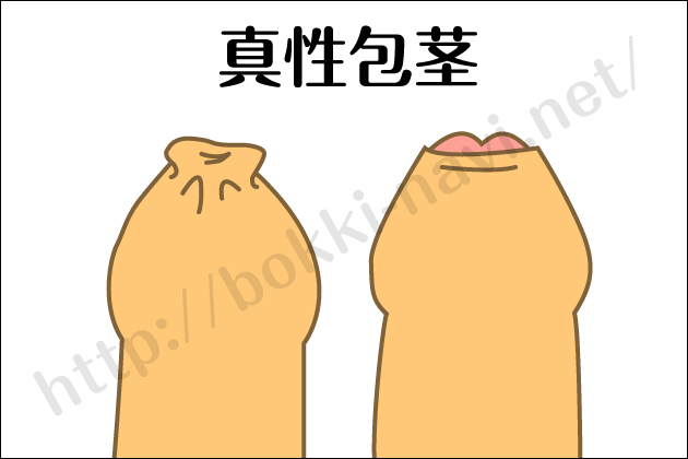 �u�NNavi�b�j����g���u���E�u�N�E��s�E���a�̏����